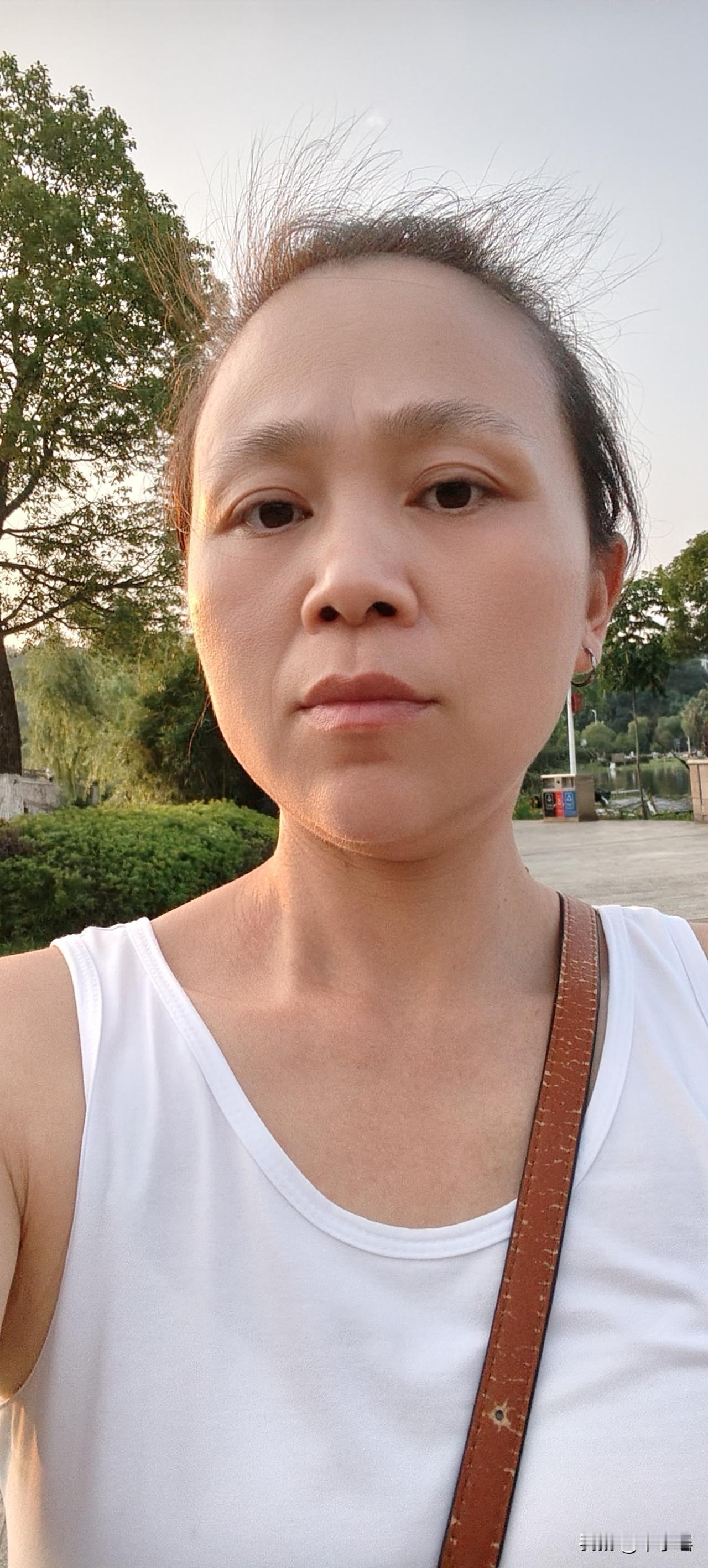 宫颈癌康复两年，明天就要到了每3个月的一次大复查，心里忐忑不安，估计晚上又要失眠