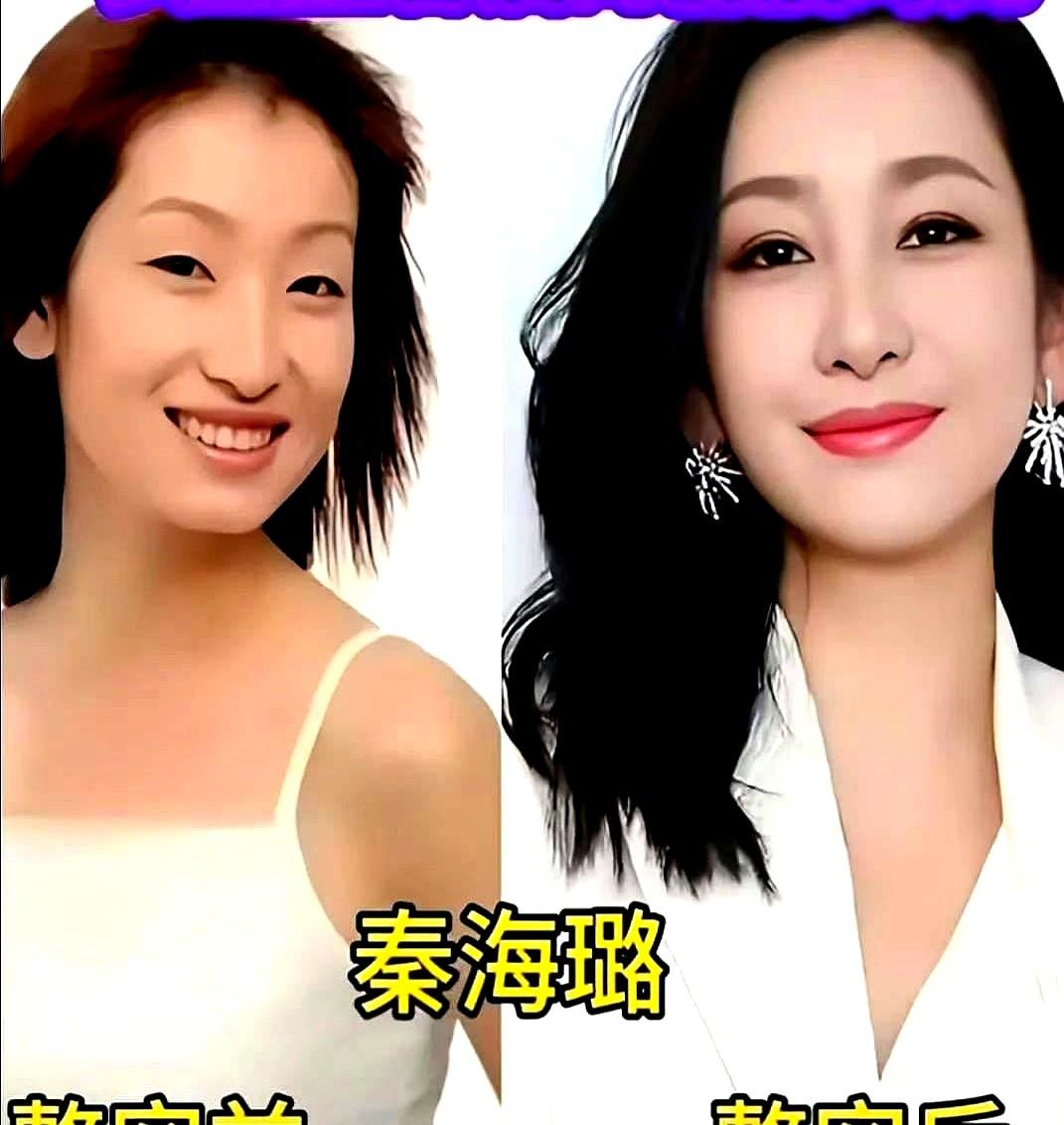 刷到一组女星今昔对比图，还真是挺感慨的。秦海璐丢掉当年那张方脸，藏起小眼睛，直