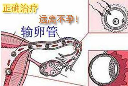 好孕总在缺席, 到底是怎么回事呢?