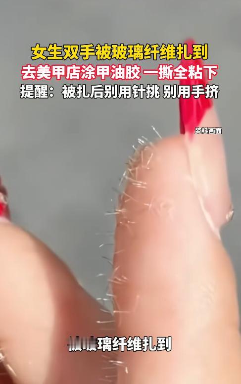浙江，一女子双手不小心沾到了玻璃纤维，扎得又刺又痒。她没有拿针瞎挑，而是跑到附近
