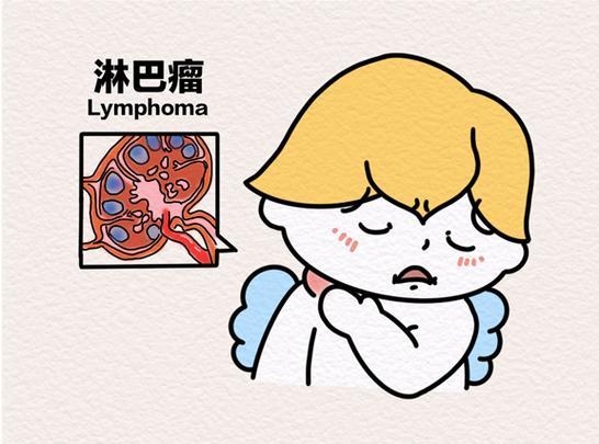 淋巴结肿大无痛属于什么病？淋巴结肿大无痛可能属于多种情况，从良性的反应性增生