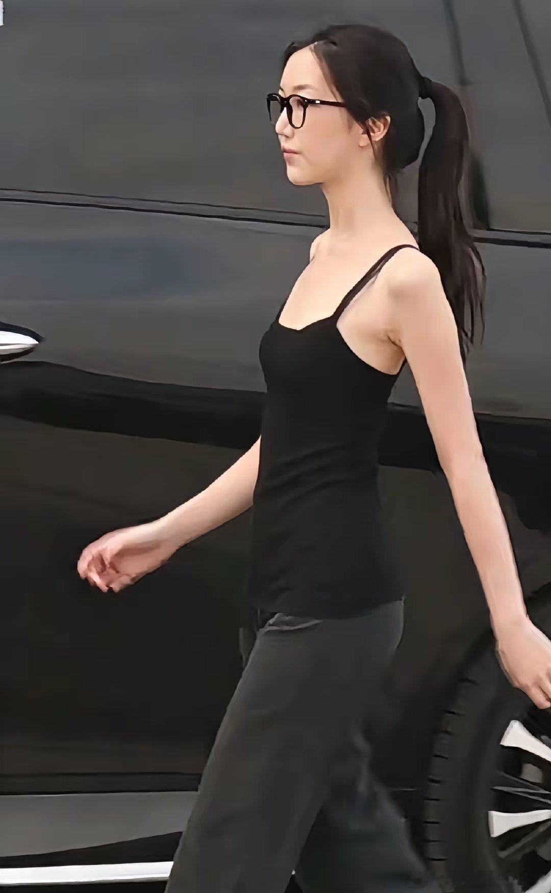 李亚鹏这么有钱，李嫣的嘴巴还是修复的不是很好，上嘴唇还是有点缺陷，不过比小时候好