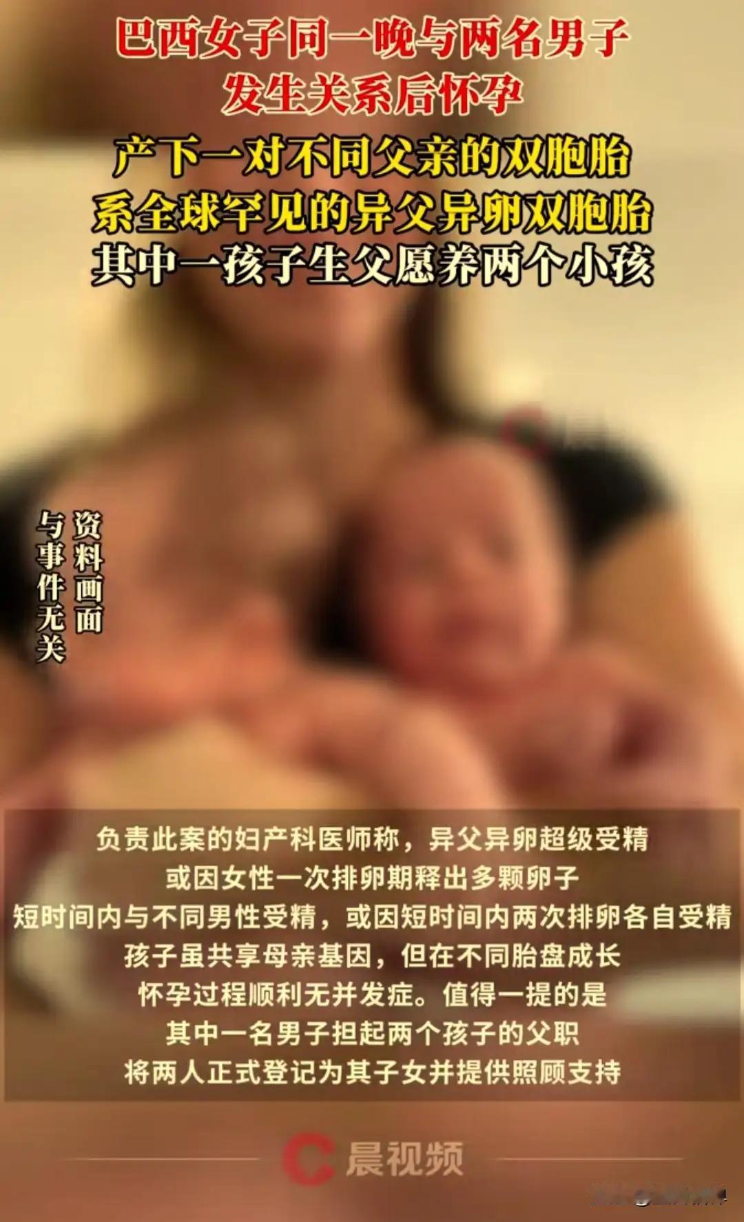 全球仅20例！巴西女子生双胞胎，亲子鉴定查出俩爹？（个人观点仅供参考，无任何