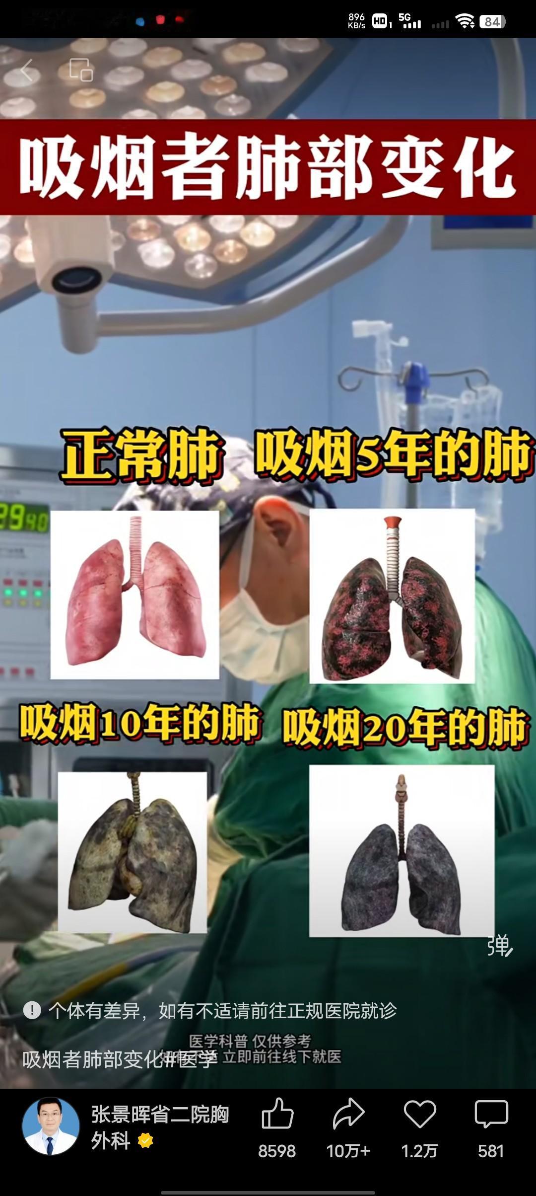 你知道是谁在阻止你戒烟吗？告诉你一个从来没有人告诉过你的残酷真相，很扎心但很现