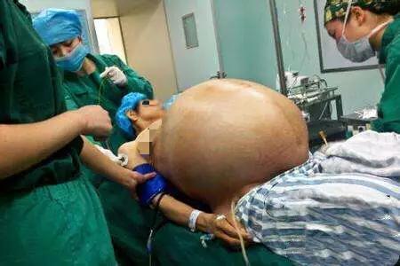 产妇剖腹产三胞胎, 婆婆看到孩子性别后, 大发雷霆把媳妇赶出家门