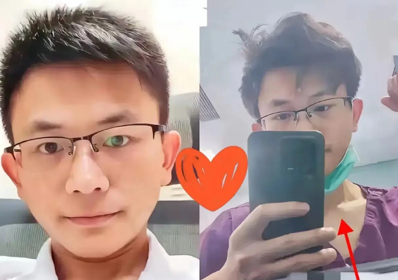 当医生的表哥偷偷告诉我罗帅宇还是太年轻了。这件事并不简单，在他们这个行业