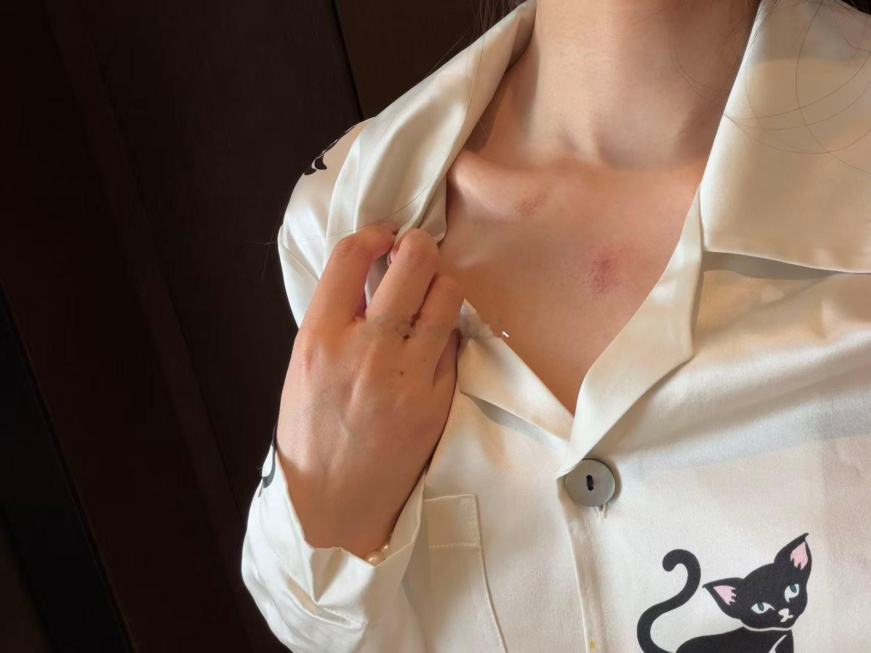 搓澡给自己搓成这样，操