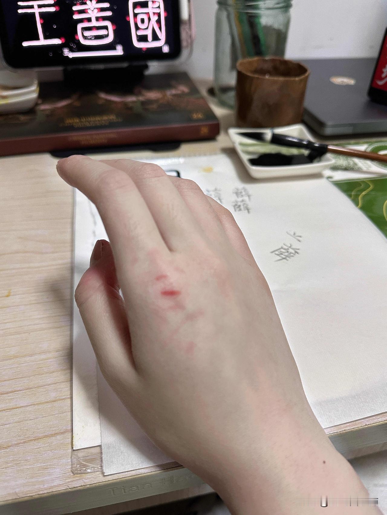 我的亲弟弟打了我2026年1月22日晚上七点我的亲弟弟打了我我在房间里听见