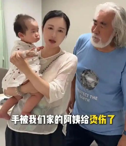 张纪中女儿被保姆烫伤！9个月宝宝手上都是水泡，杜星霖快急哭了