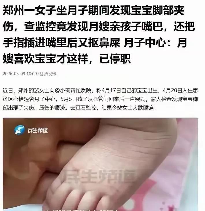月嫂就是这么喜欢孩子的。郑州一家高端月子中心。孩子的脚踝被夹伤，父母查看监控