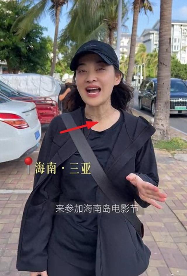 梅婷一段无滤镜视频被说“像60岁”。舆论却一片叫好。这合理吗？我认为，这才