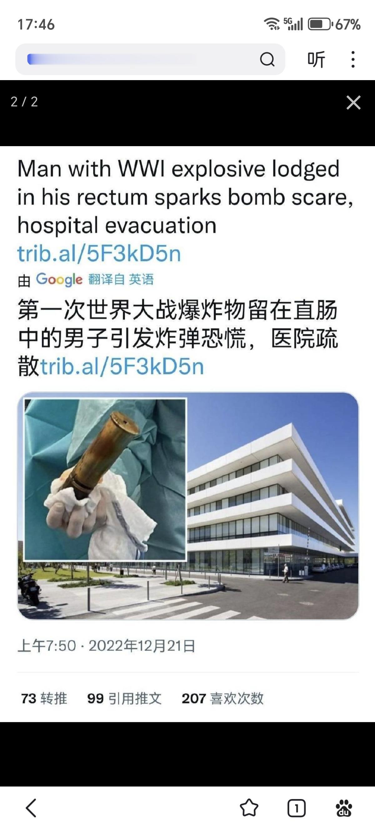 几年前一个88岁的法国老头不小心把第一次世界大战的炮弹卡进了自己的直肠。医生给他