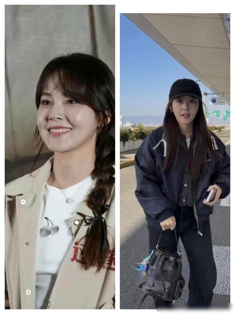 果然，明星的尽头是医美！张佳宁以前那么灵动的一个女孩子，居然也会去做医美！最