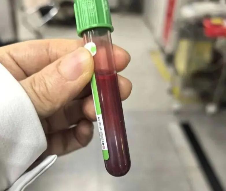 “悲剧还是发生了”！2026年2月，浙江，一女子怀孕时，患了妊娠期糖尿病，所以严