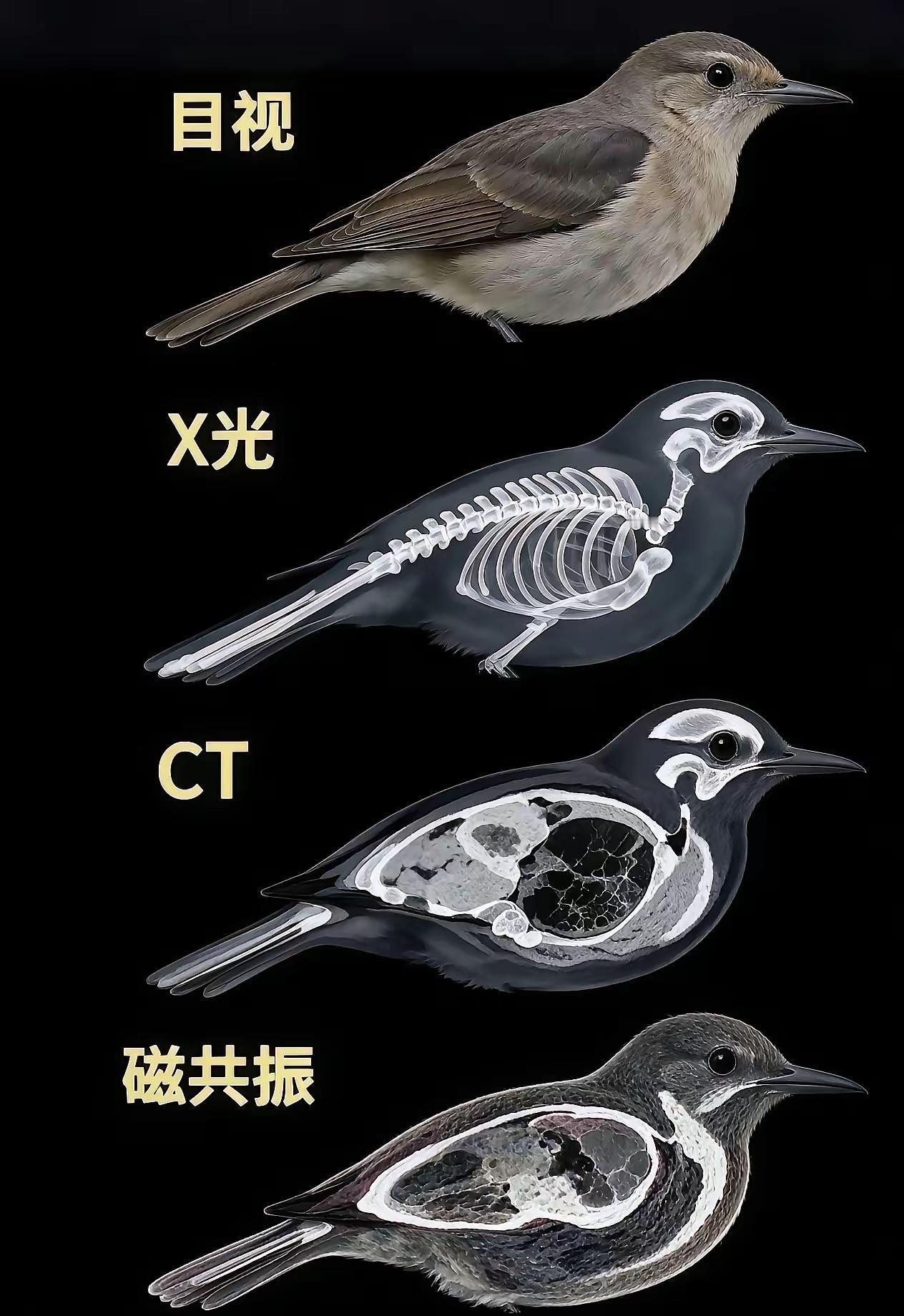 难怪核磁共振那么贵！