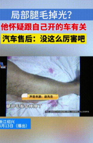 这下解释不清了！”浙江诸暨，男子驾驶新能源车1年后，忽然看到自己两条腿上本来茂密