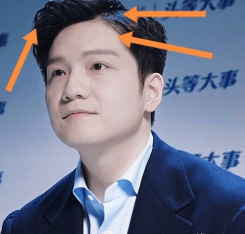 8.28官宣海飞丝商务的樊振东最抢镜的不是他的穿搭，也不是他的笑容，而是: