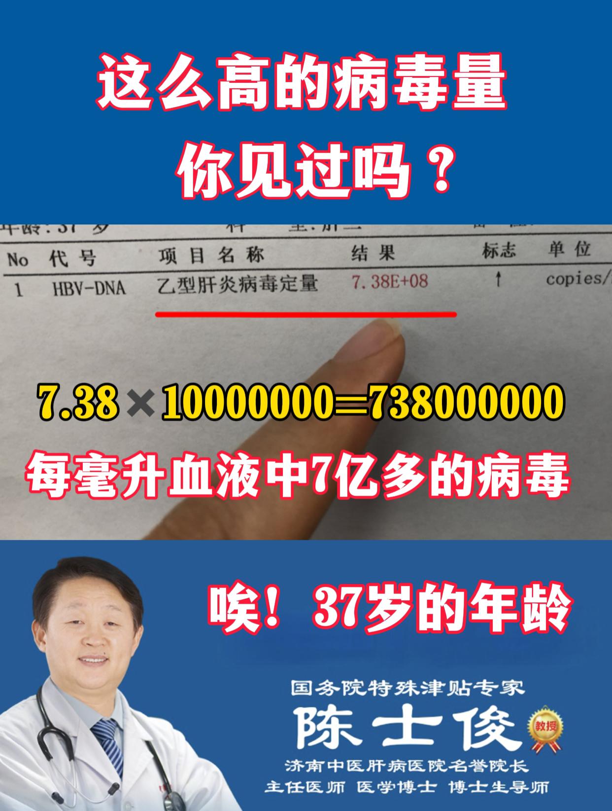 大家好，我是陈士俊教授！看乙肝大三阳、小三阳、肝硬化已经40年了，遇见...