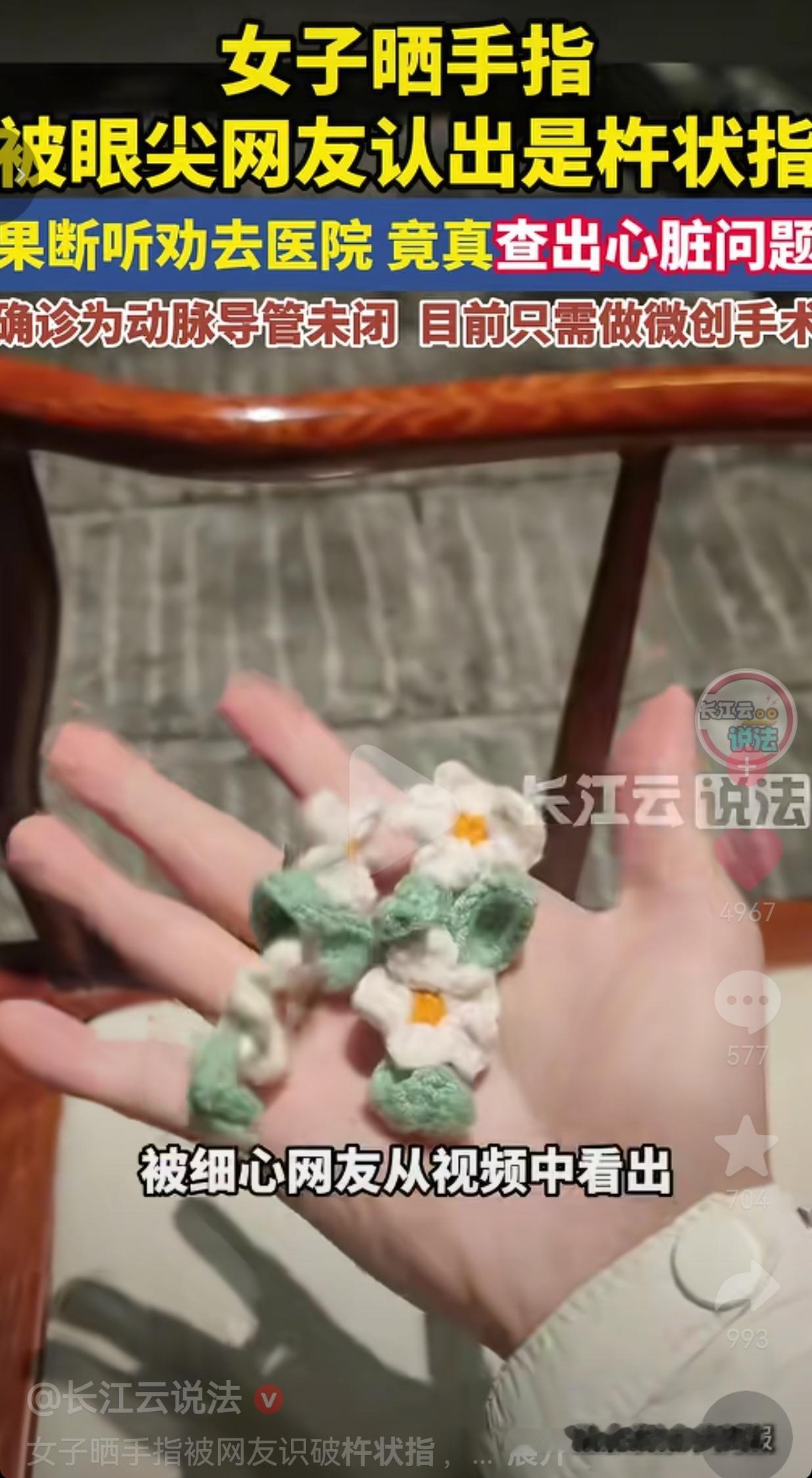 多亏了网友！湖南长沙一女子晒自己的钩织作品，就因为手指入镜，被眼尖网友一眼认出是