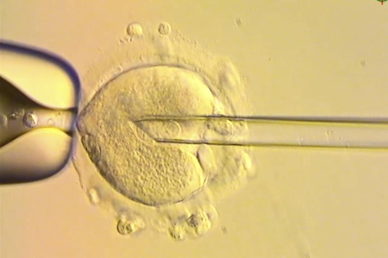 震惊！'三亲婴儿'真相：0.1%的基因改变竟引发法律伦理大震荡！