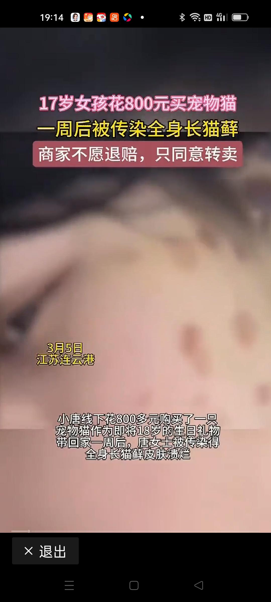 17岁女孩花800元买宠物猫一周后被传染全身长猫癣原本以为买只萌萌的小猫能带