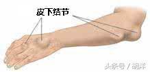 身体出现哪些信号表示该去医院做检查了?