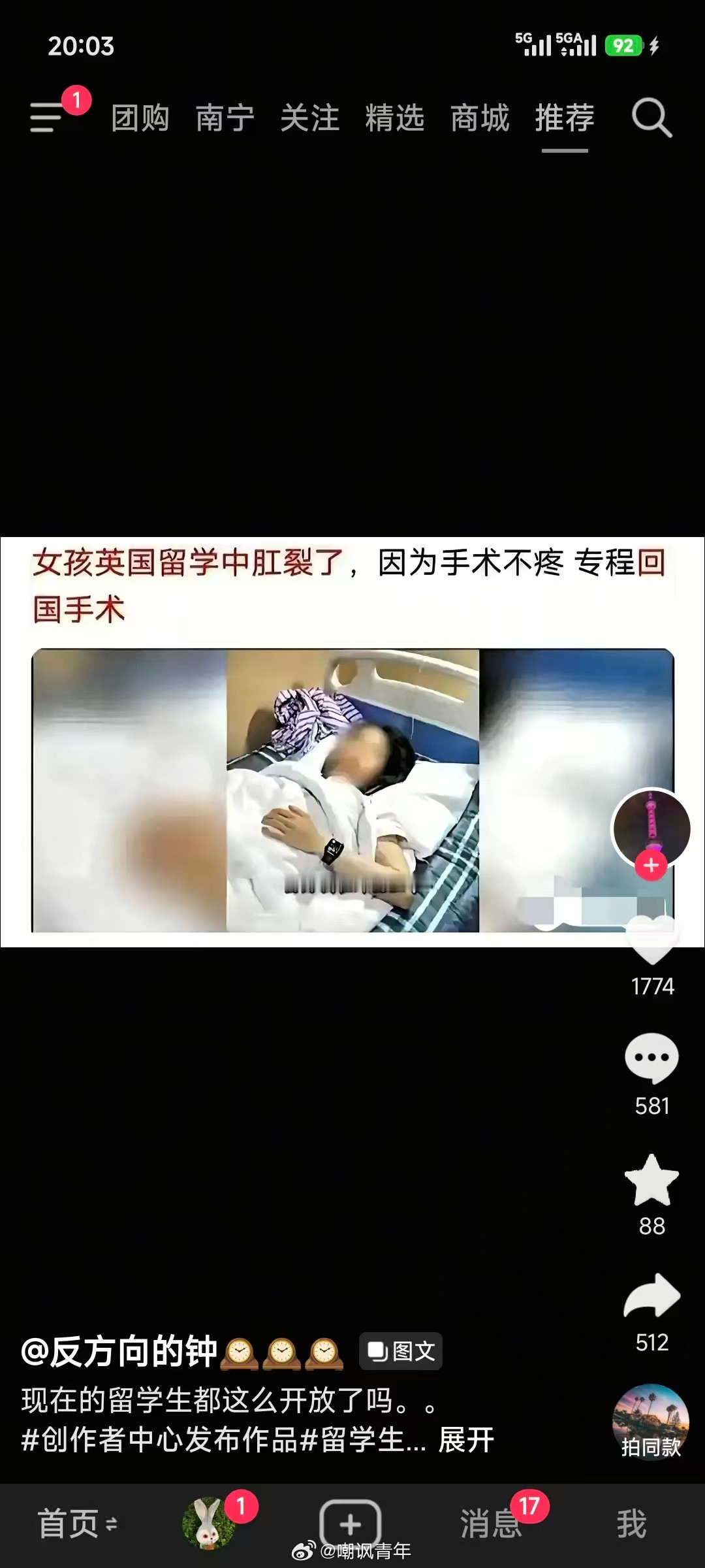 瞎说什么呢，正常人也有概率肛裂吧