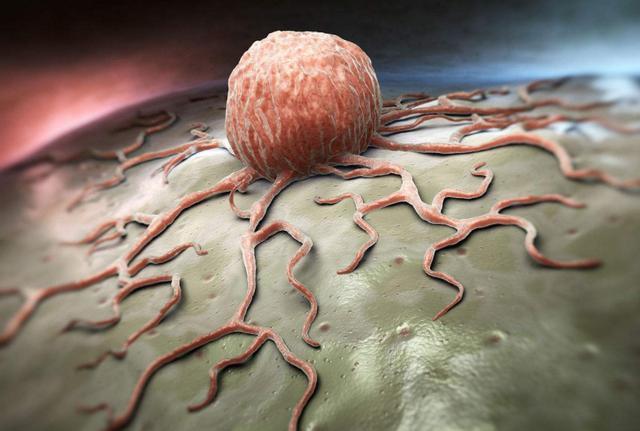 癌细胞科普: 体内有一个细胞病变了, 就一定会发展成癌症吗