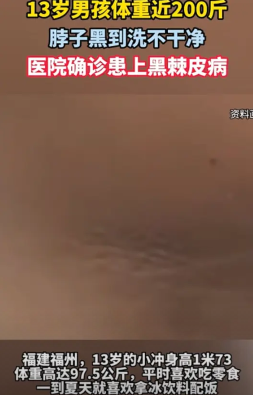 “幸亏发现早！”福建，13岁男孩长到1米73，就在家人们以为他能长大1米9的时候