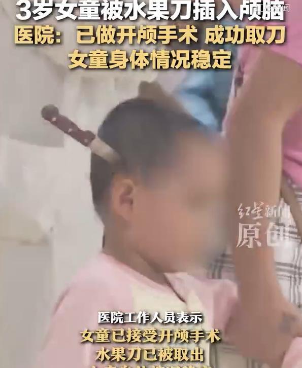 “心真大！”云南昆明3岁女孩玩耍时，不慎将水果刀插入头颅，妈妈看到后，没有慌也没