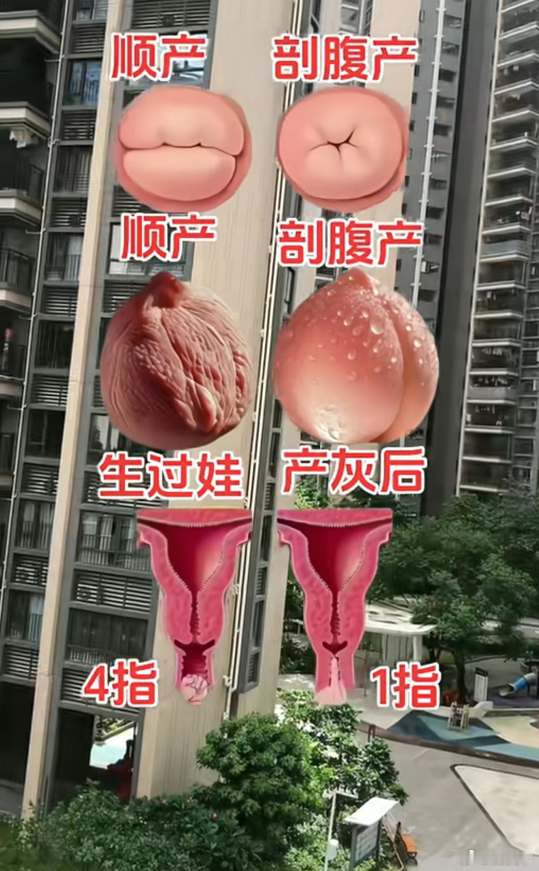 这就是明星都选剖腹产的原因！
