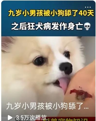 九岁小男孩被狗狗舔伤口舔了四十天，以后狂犬病发作身亡。现在只要被狗咬了，有伤