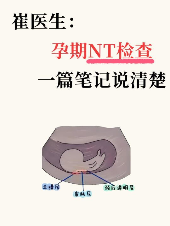 💥孕妈必看！NT检查详细指南来了🎉