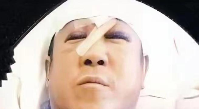 2001年，曾志伟在香港九龙一家私人会所遭三名男子袭击，头脸缝了29针。事后圈内