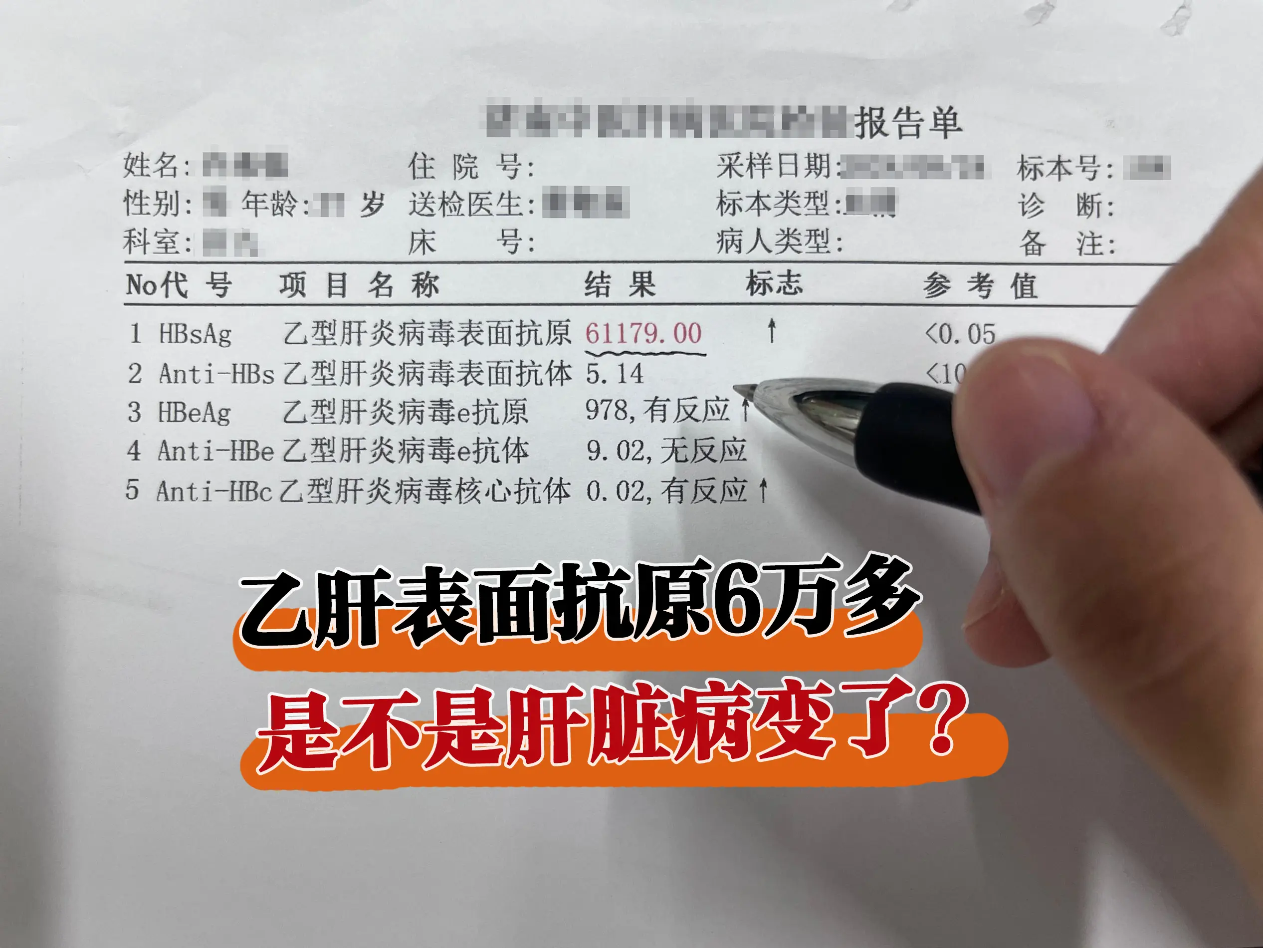 上周末接诊了一位患者，乙肝10多年了，这次复查结果显示是个乙肝大三阳...