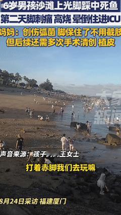 长见识了！福建厦门，6岁男孩在沙滩上光脚玩耍后莫名高烧呕吐，母亲以为是中暑，结果