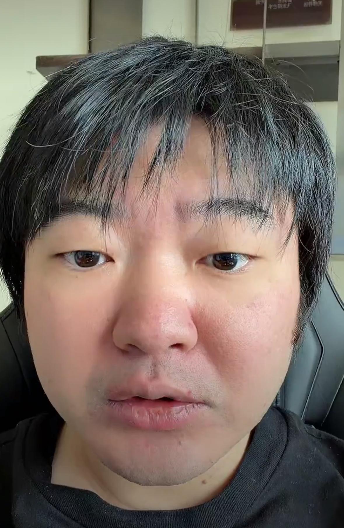 知名综艺导演吴彤被下病危通知书，年仅40岁，通知书上写道：血压极高有猝死风险，就