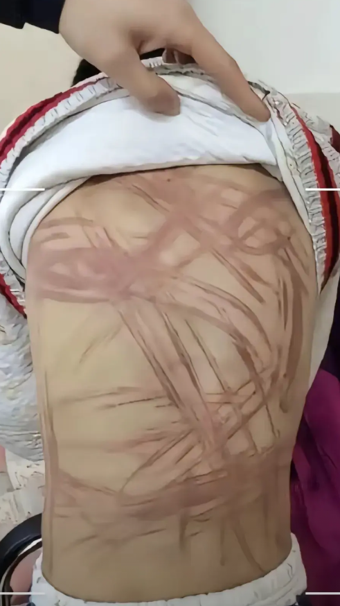 简直是丧心病狂！”在上海，有一名男子为了将女儿丢给前妻抚养，总是用电线、皮带抽打