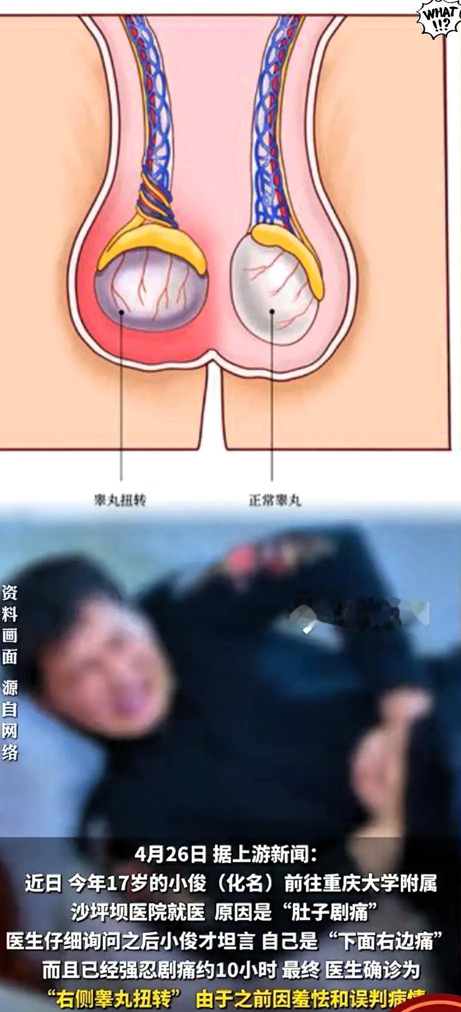 重庆17岁的小伙子，给所有的青春期的小青年上了一课！很多家庭受传统观念影响，对青