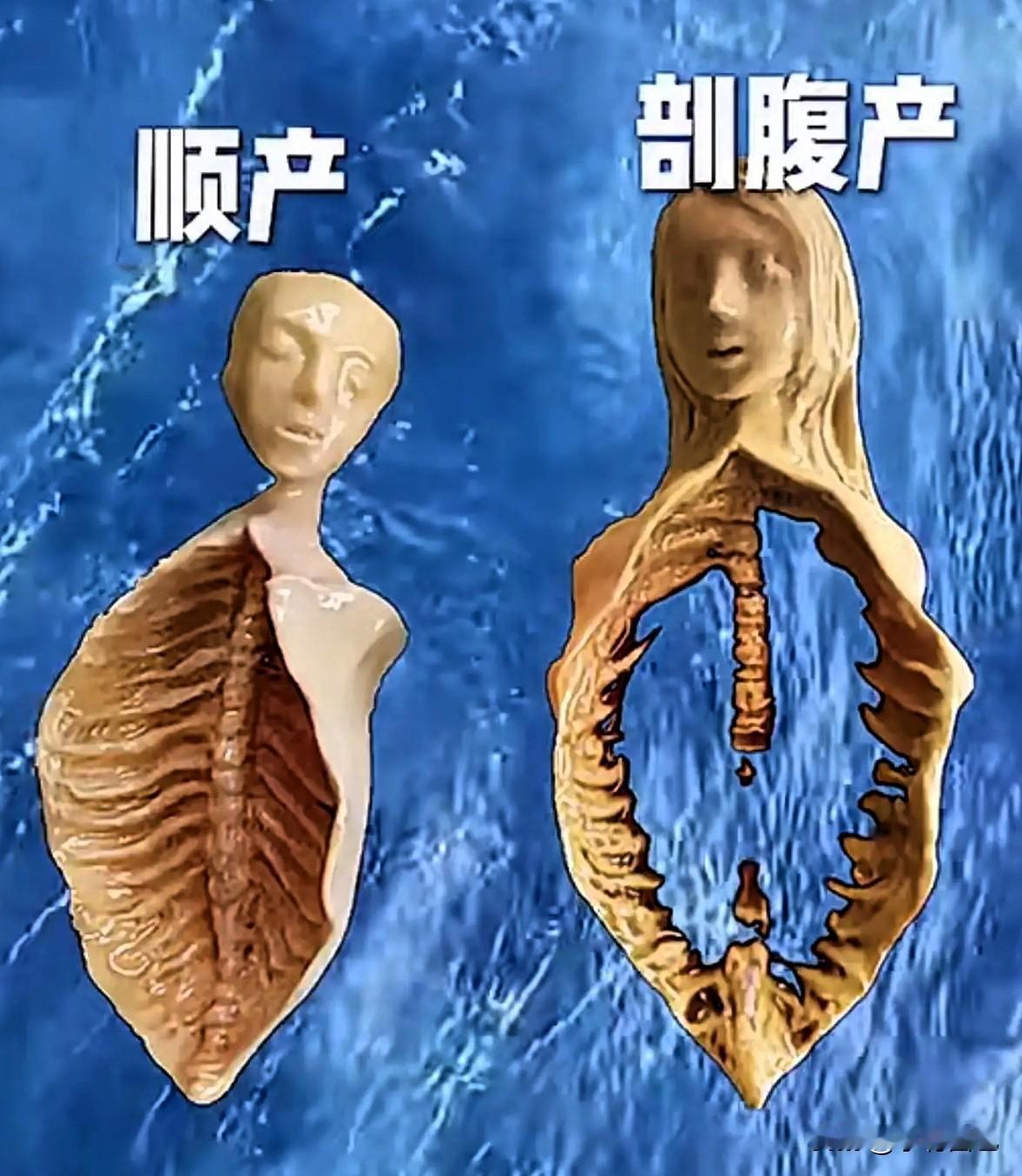 顺产对女人好，剖腹产对男人好生完老大顺、老二剖，顺产疼一时，剖腹产疼一世，而最