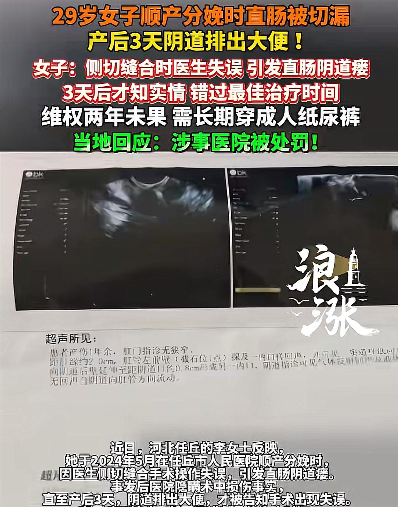 “太坑人了”河北任丘，29女子岁在某医院顺产生娃，3天后，突然在阴道里排出大便，