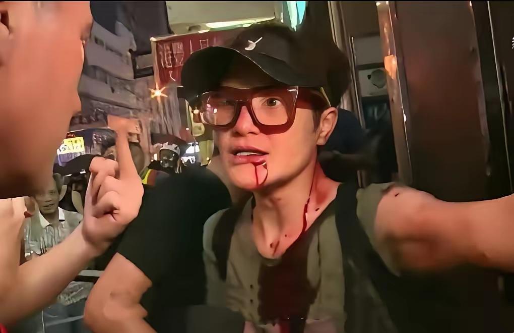 TVB那个演了一辈子丑角的马蹄露，这次把遮羞布扯下来了。最近张敬轩摇身一变，成了