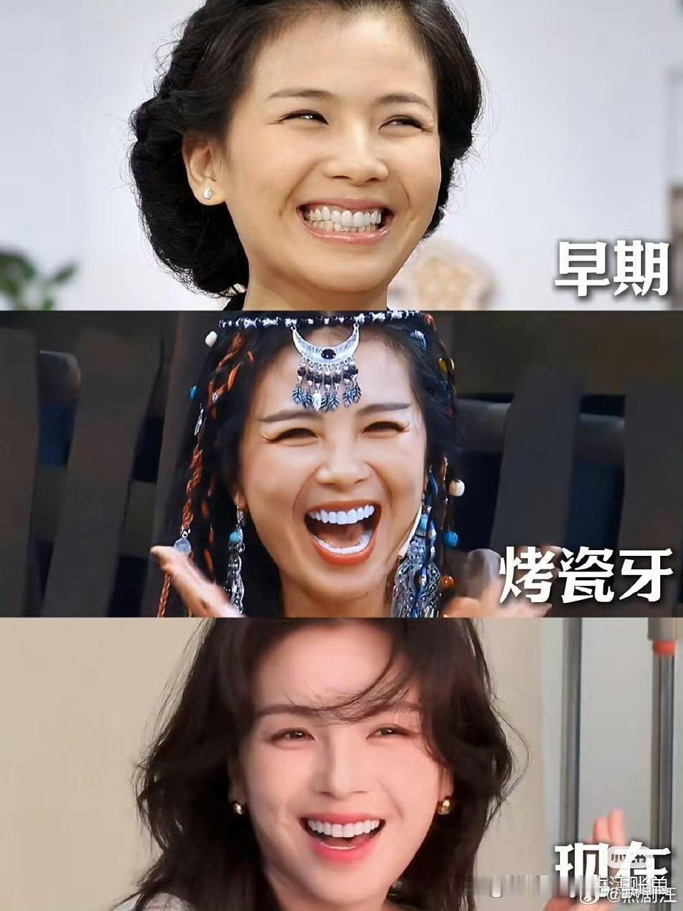 据说刘涛这一口牙花了三百万，值不值？​​​​