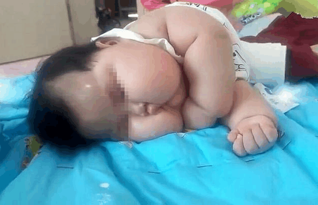 看看孩子脸上这两团肉, 妈妈你确定喂孩子的方式正确吗?