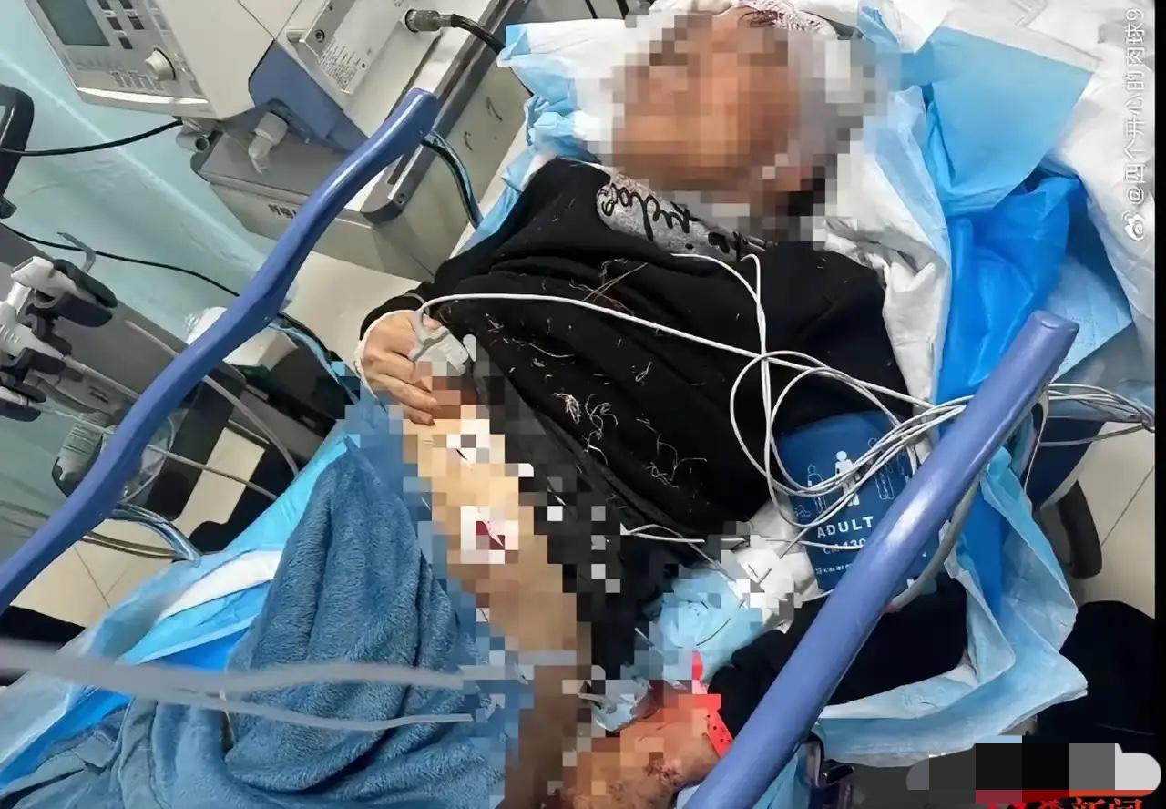 “必须严惩！”吉林长春，62岁老人在徒步时，突然被从附近院子冲出的7只大狗扑倒。