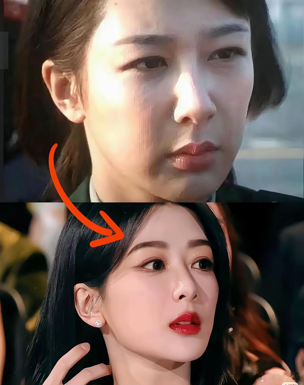 除了杨紫和朱珠，有些女星整容之前本身长得也是很好的。