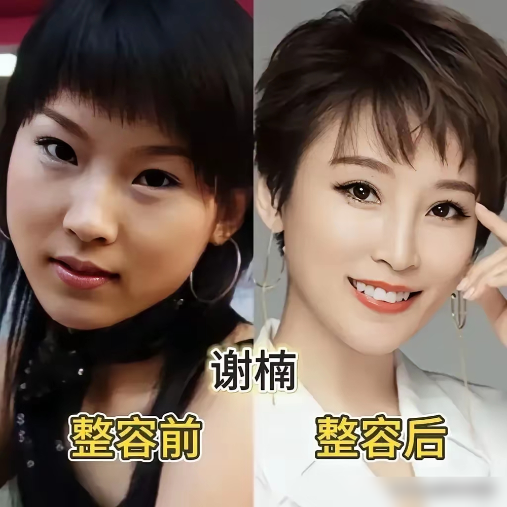 张艺谋选角有多狠？脸上动过一刀，直接不要。他说整容把肌肉和神经都破坏了，大银幕上脸要放大几万倍，一丁