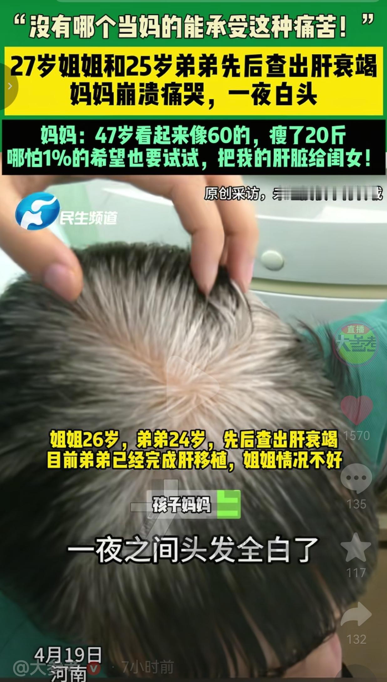 27岁姐姐和25岁弟弟双双肝衰竭，47岁妈妈白了头：我愿把肝给女儿！世界上