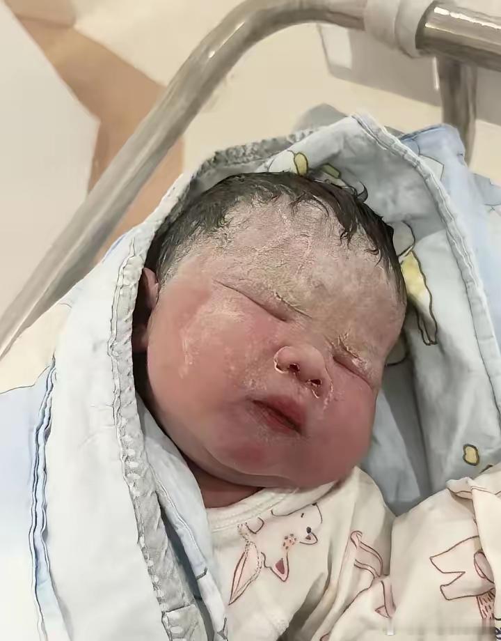 千万不要因为自己的无知害了宝宝1.出生1小时内尽早皮肤接触并开奶,没下奶时多让