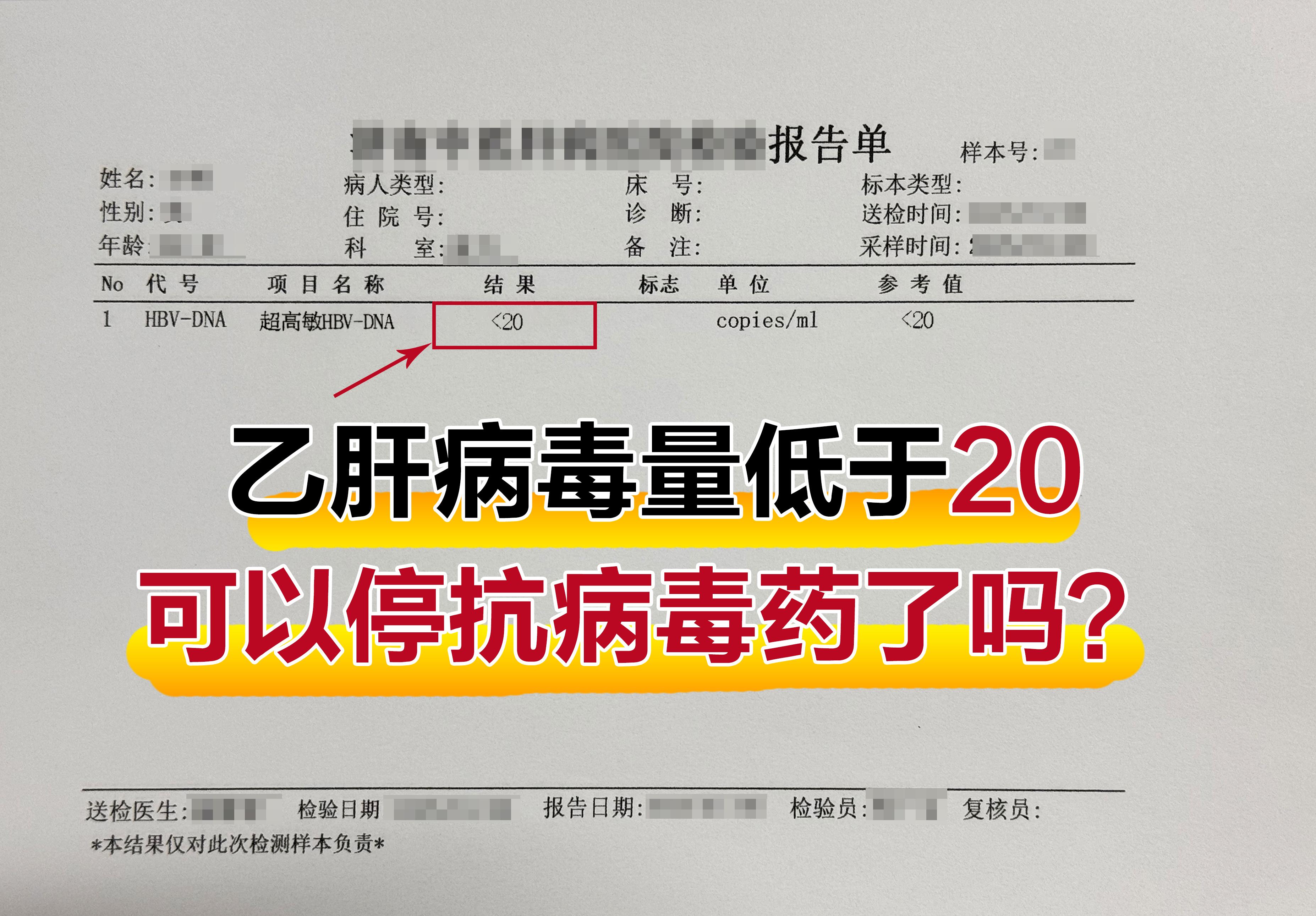 不少乙肝患者发现病毒量低于20IU/mL，问是不是可以停药了？  病毒...